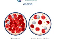 Anemia